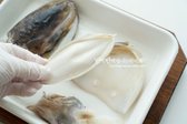 연골조직 역시 제거해줍니다.